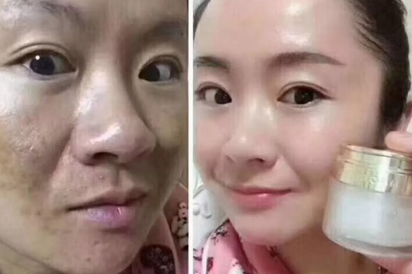 <b>麦吉丽护肤品去斑吗,美颜贵妇膏真的好用吗？</b>